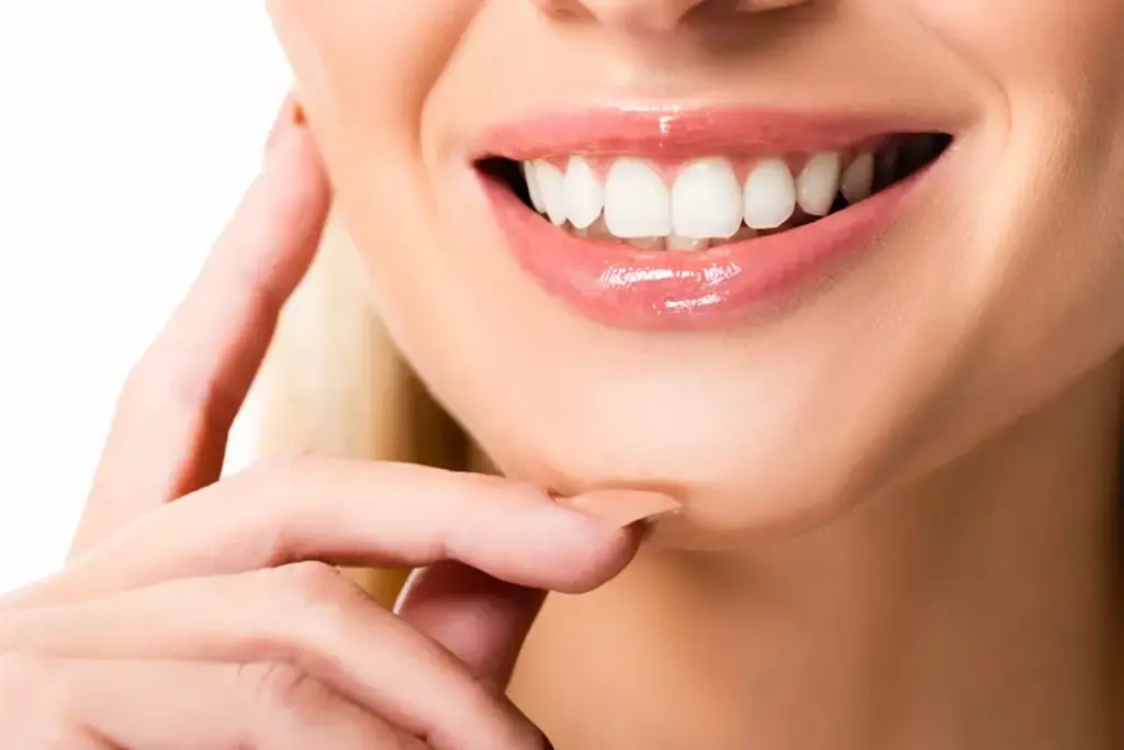teeth-whitening-del-mar